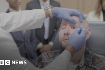 Arkansas man receives world's first eye transplant