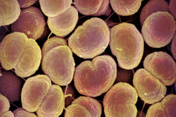 Gonorrhea Is Becoming Drug Resistant. Scientists Just Found a Solution.