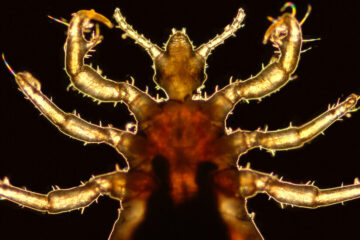 Lice Genes Offer Clues to Ancient Human History