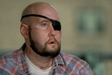 Man makes medical history after successful eye transplant