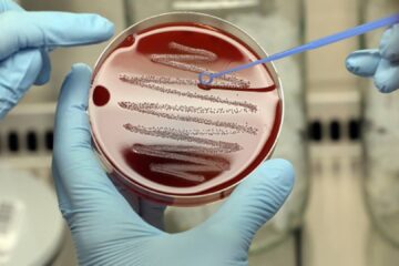 'The silent pandemic': A hotter world makes it harder to stop the spread of deadly superbugs