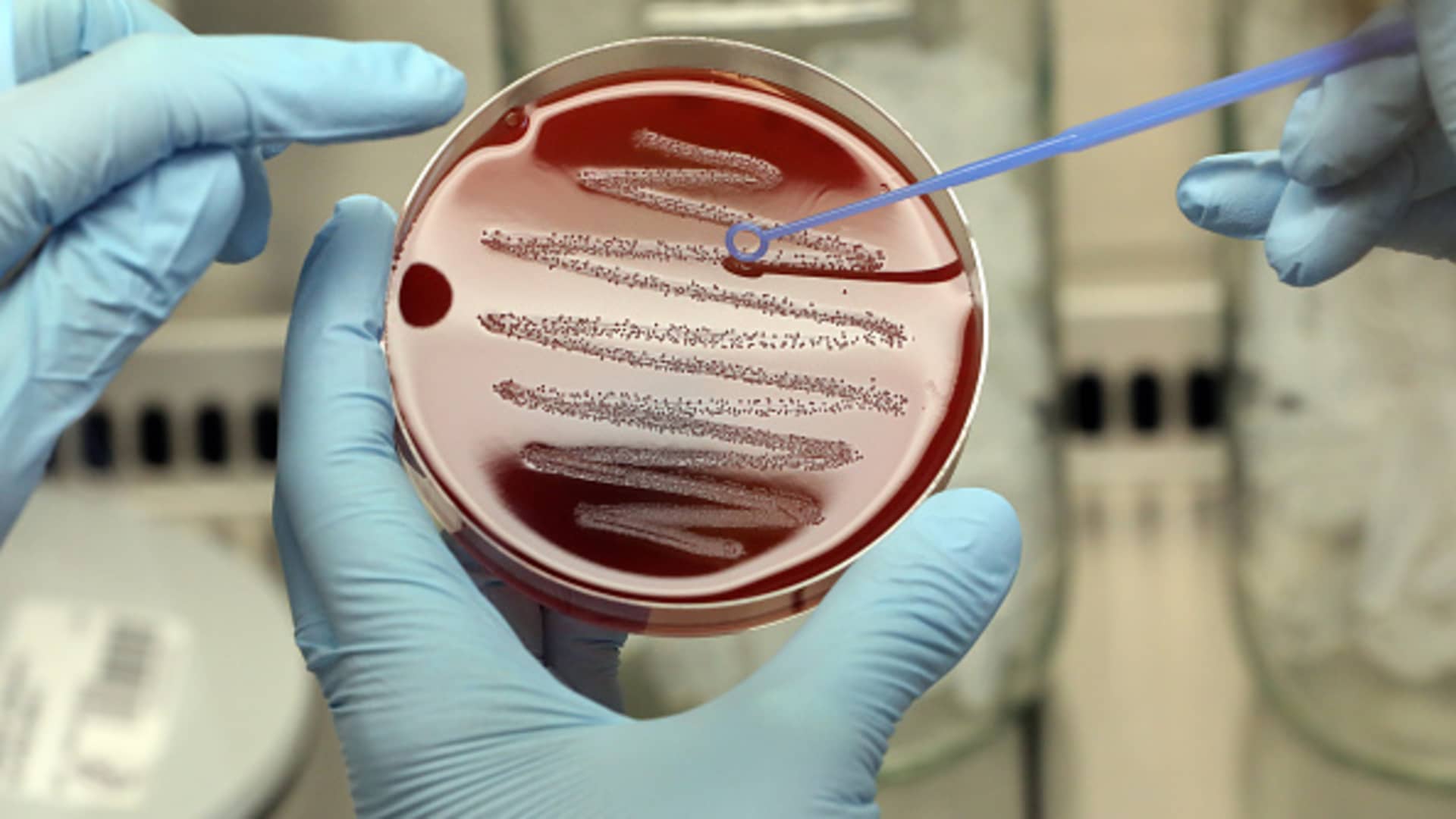 'The silent pandemic': A hotter world makes it harder to stop the spread of deadly superbugs