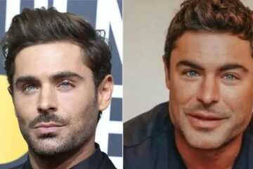 Zac Efron goes under the knife for multiple face changes?