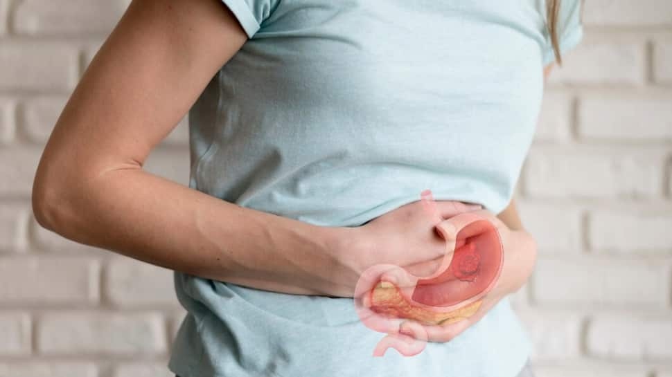 Is Loss Of Appetite Sign Of Stomach Cancer? Check Symptoms And Early Diagnosis, Expert Shares