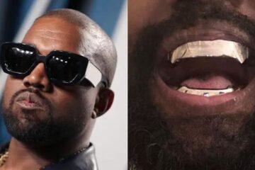 Kanye West's ‘detrimental' titanium teeth render rapper unable to chew