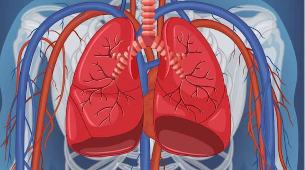 Research Connects Colourless, Odourless Gas to Increase In Nonsmokers Lung Cancer